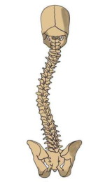 An image of a scoliosis spine