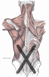 Anatomical diagram of the thoracolumbar fascia
